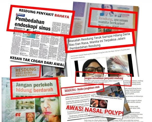Keratan akhbar tentang bahaya resdung